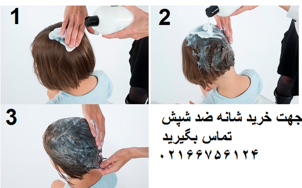عکس شانه شپشی