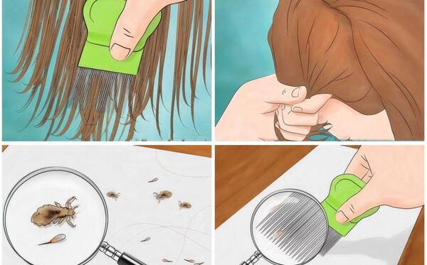 عکس شانه مخصوص شپش