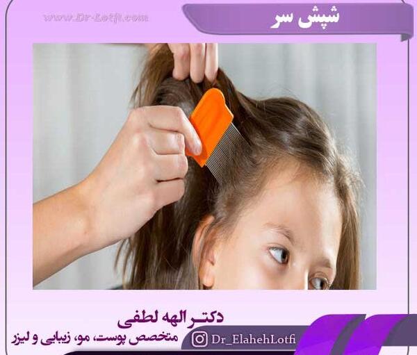 عکس شانه مخصوص شپش