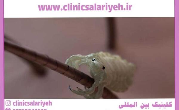 عکس تخم شپش زیر میکروسکوپ