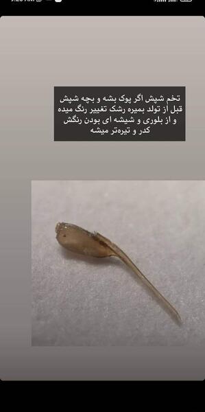 علائم شپش عکس رشک مرده و زنده