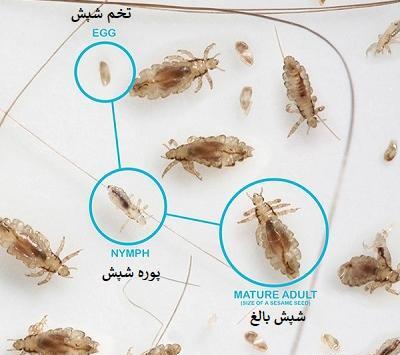 علائم شپش عکس رشک مرده و زنده
