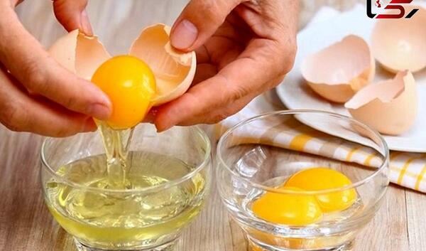 عکس تخم شپش سر کودک