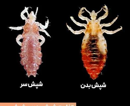 عکس واقعی از شپش سر