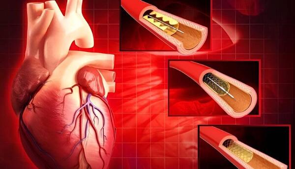 عکس زی استین ضربان قلب