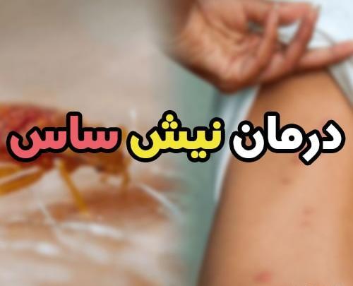 عکس گزیدگی کنه