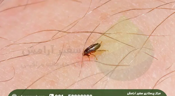 عکس گزش کنه کبوتر