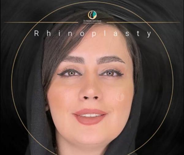 عکس بینی نیمه فانتزی طبیعی