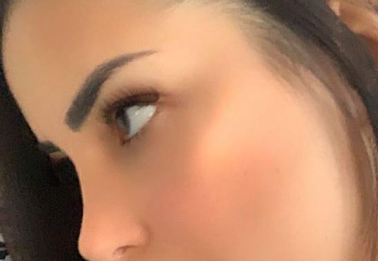 عکس بینی نیمه فانتزی طبیعی