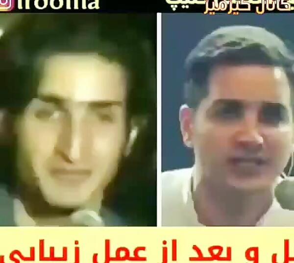 عکس قدیمی محسن یگانه قبل عمل