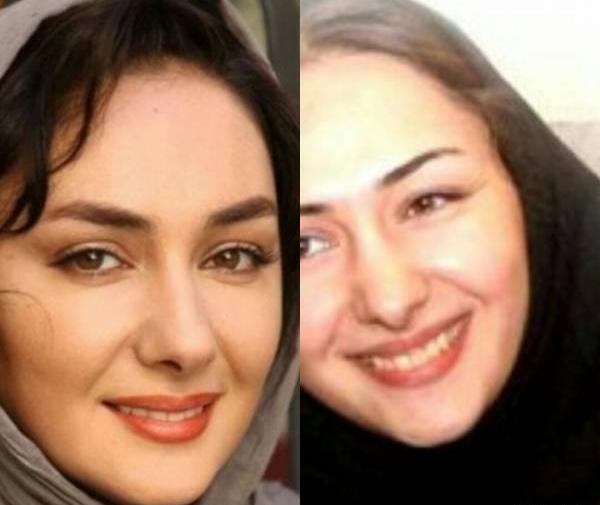عکس قدیمی محسن یگانه قبل از عمل بینی