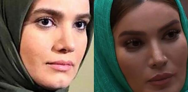 عکس قدیمی و جدید متین ستوده
