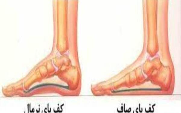 عکس پای قوی