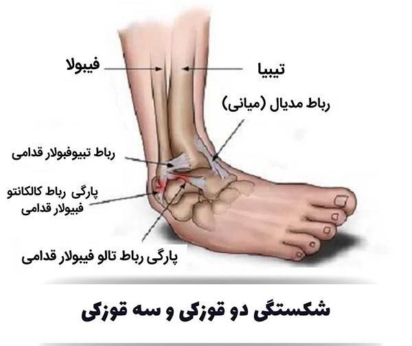 عکس قوزک پای سالم
