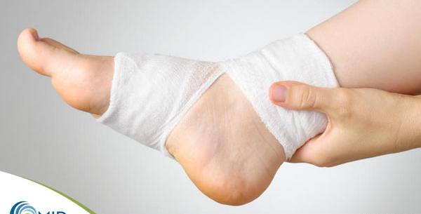 عکس قوزک پای سالم