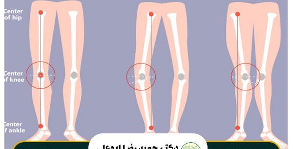 عکس قوزک پای سالم