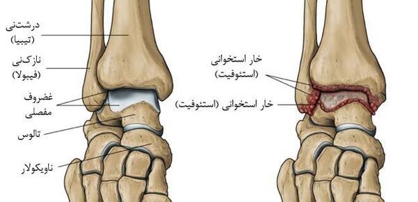 عکس قوزک پای سالم