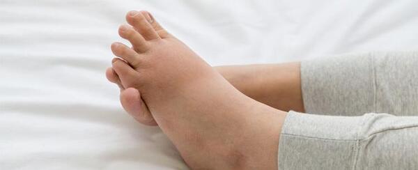 عکس قوزک پای شکسته