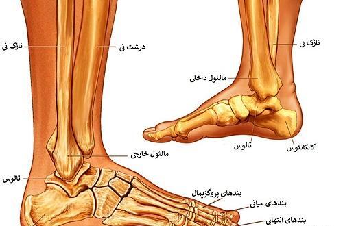 عکس قوزک پای شکسته