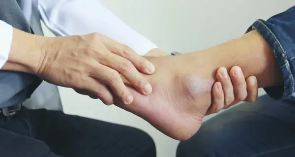 عکس قوزک پای شکسته