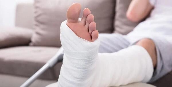 عکس قوزک پای شکسته