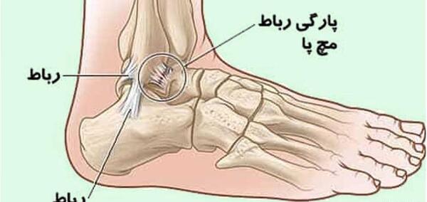 عکس قوزک پای