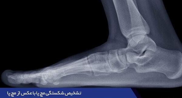عکس قوزک پای