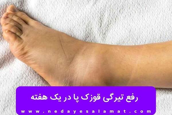 عکس قوزک پای