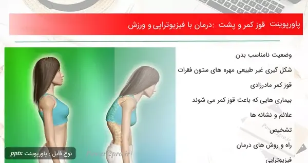 عکس از قوز کمر