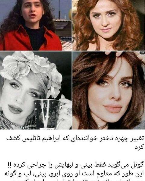 عکس قدیمی گونل خواننده ترکیه