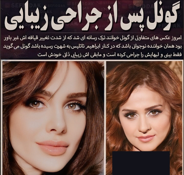 عکس قدیمی گونل خواننده ترکیه
