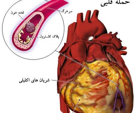 عکس قلب در بدن ما