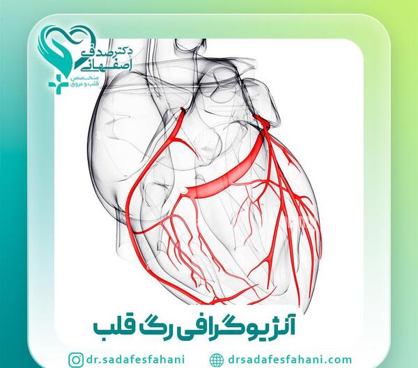 عکس رگ قلب گرفته