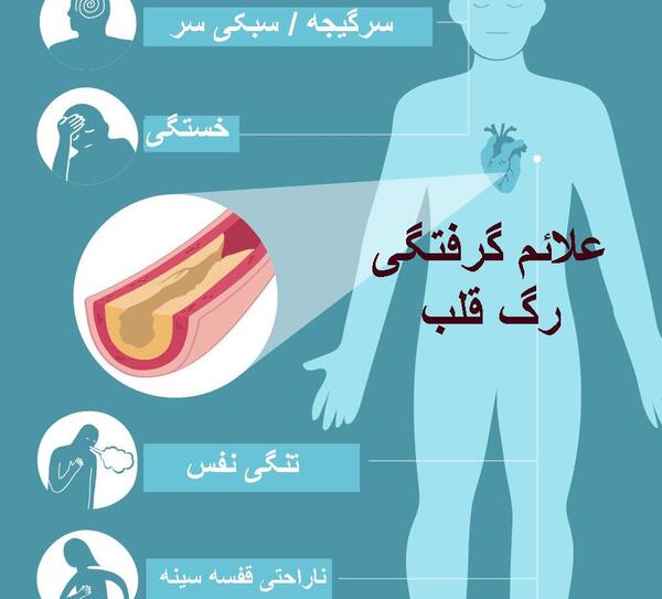 عکس رگ قلب گرفته