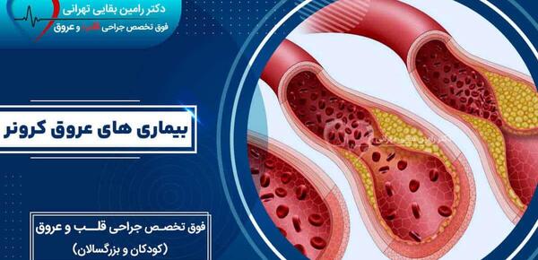 عکس رگ قلب گرفته
