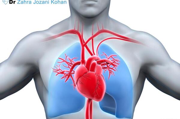 عکس رگ قلب گرفته