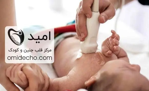 عکس قلب سوراخ نوزاد