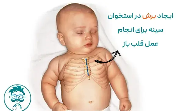 عکس عمل قلب نوزاد