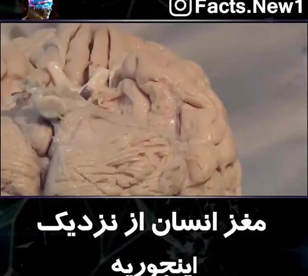 عکس قلب و مغز واقعی