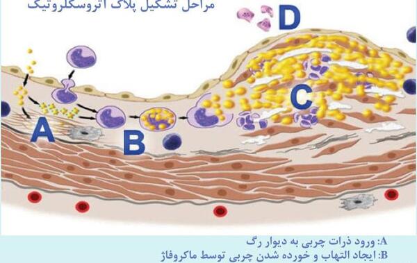 عکس هسته ای قلب چگونه انجام میشود