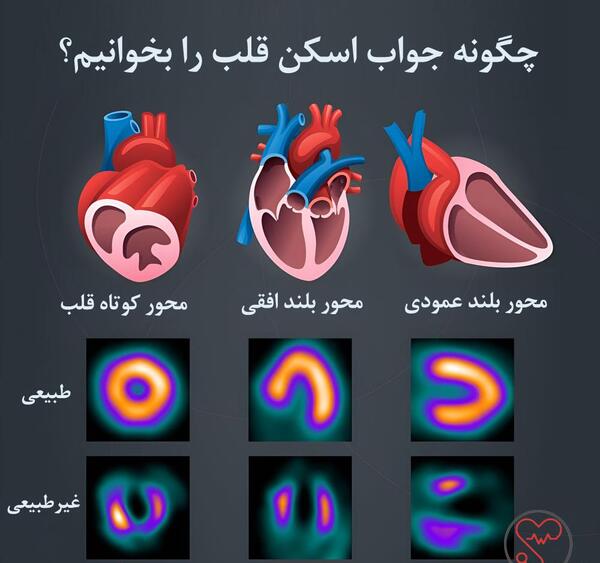 عکس برداری هسته ای از قلب
