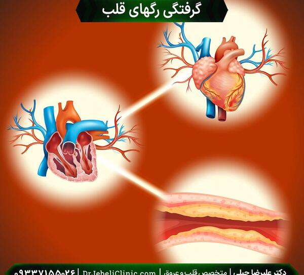 عکس رگهای گرفته قلب