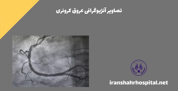 عکس سرخرگ قلب