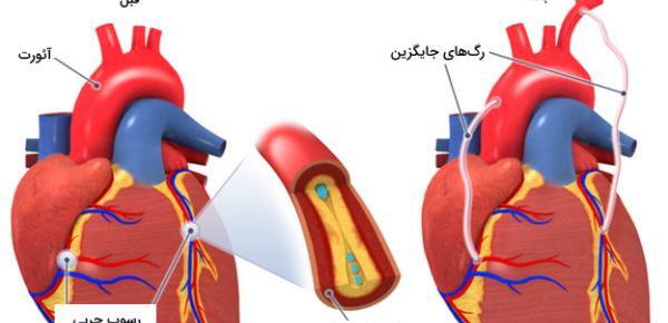 عکس سرخرگ قلب