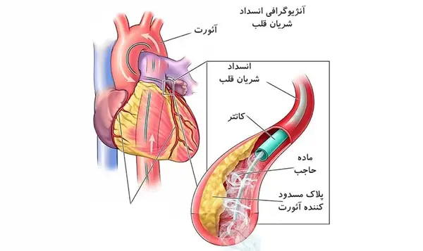عکس قلب جدا شده