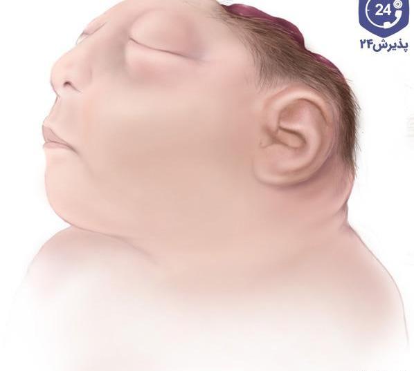 عکس بچه ی فامیل دور
