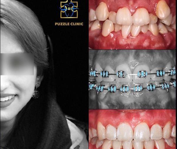 عکس های فرشته دندون
