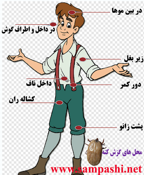 عکس کنه رو بدن انسان