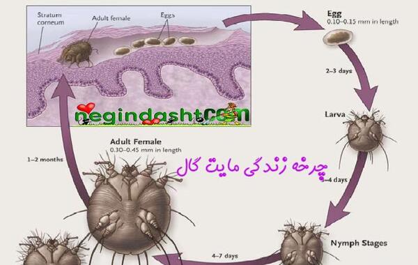 عکس کنه گال