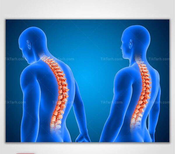 عکس کارتونی ستون فقرات